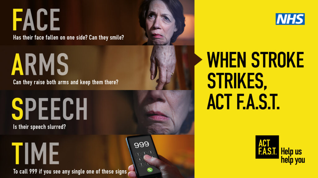 Face: Has their face fallen on one side? Can they smile? Arms: Can they raise both arms and keep them there? Speech: Is their speech slurred? Time: To call 999 if you see any single one of these signs. WHEN STROKE STRIKES, ACT F.A.S.T.